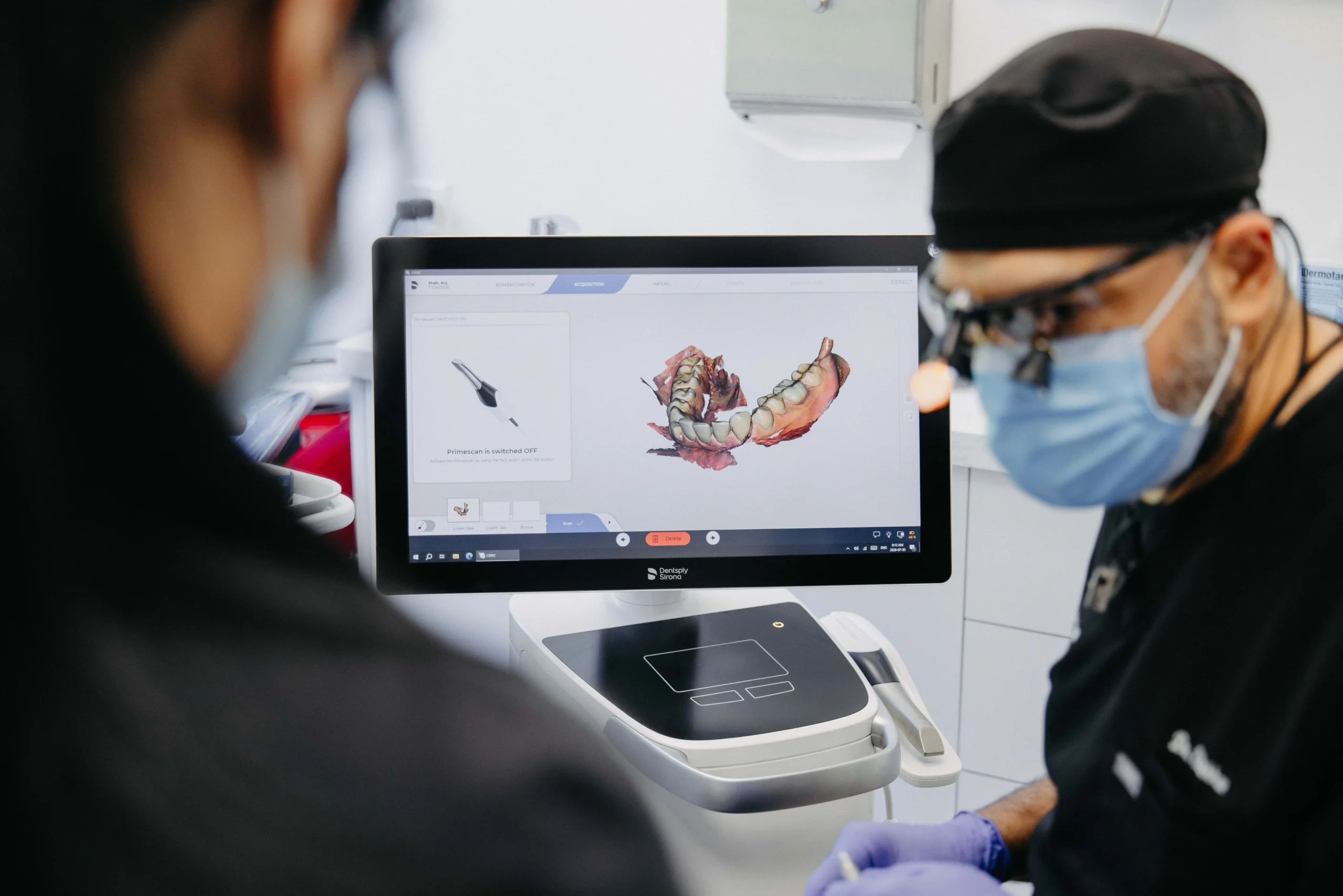cerec digital impression and 3d model