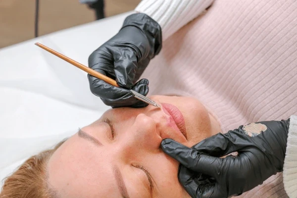 cold sore laser therapy near you