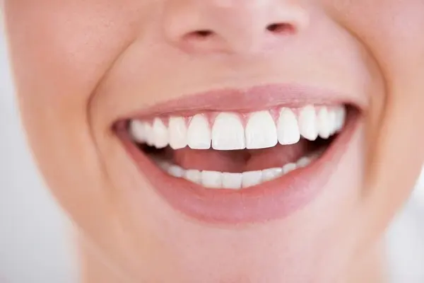 cosmetic dentistry in delta, bc