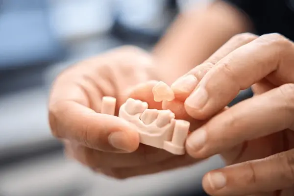 dental crowns in delta, bc