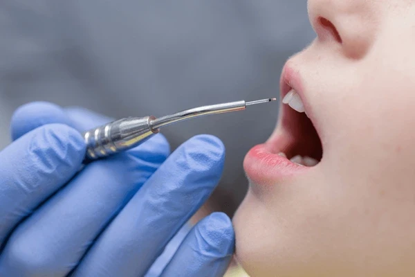 hard tissue laser dentistry near you