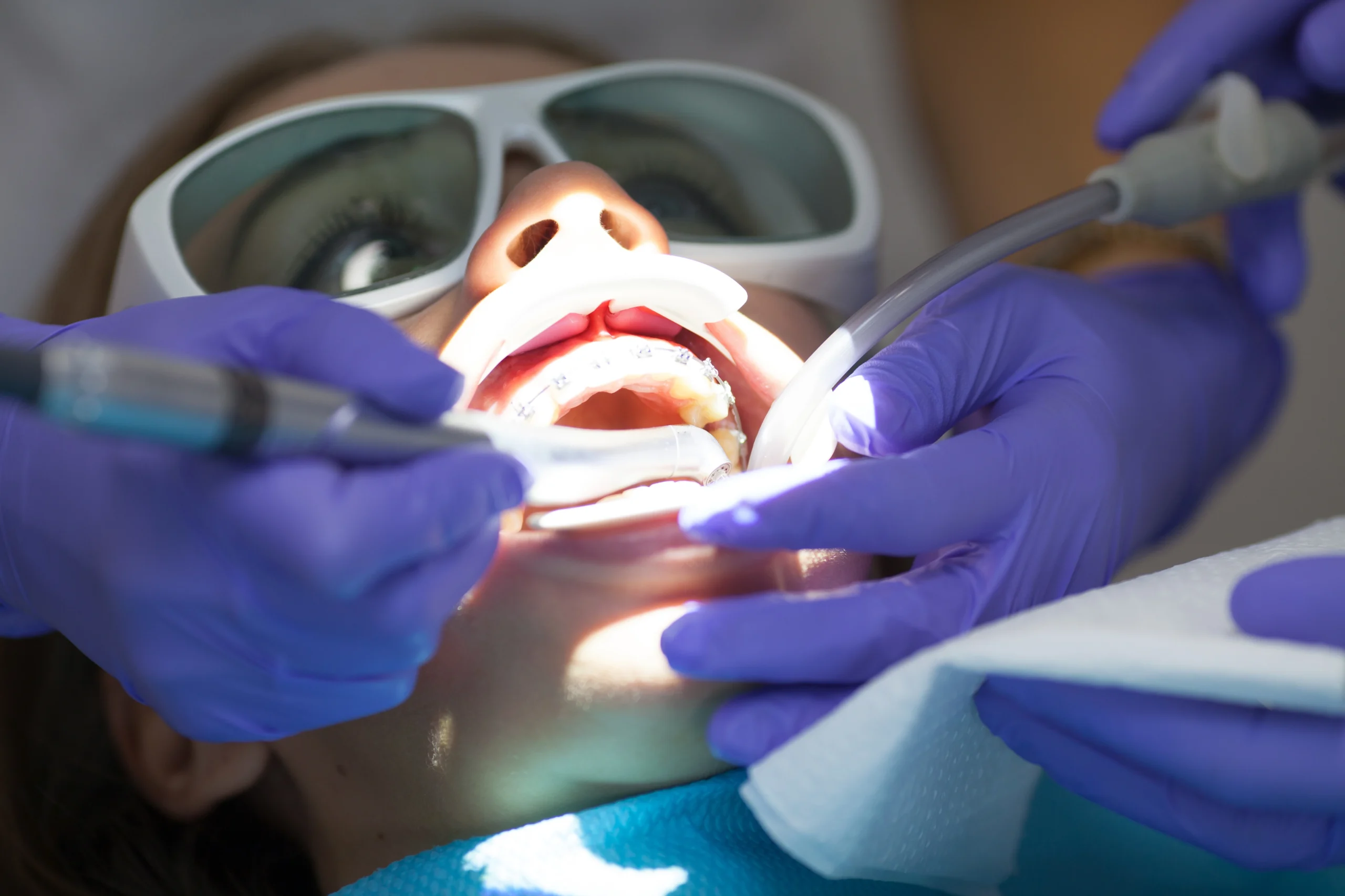 hard tissue laser dentistry