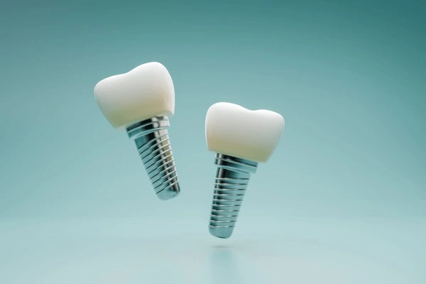 implant restorations in delta, bc