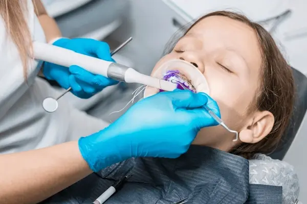 needle free childrens fillings in delta, bc