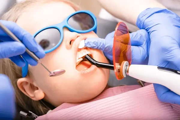 pediatric dental fillings in delta, bc