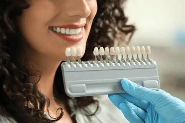 porcelain veneers in delta, bc