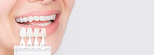 porcelain veneers near you