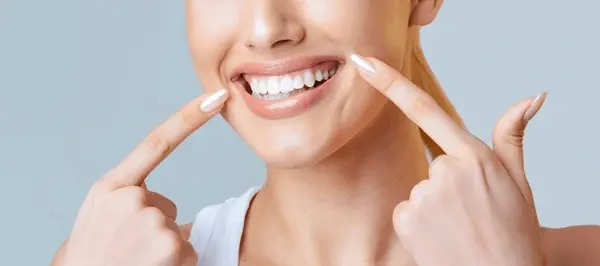 smile makeovers in delta, bc