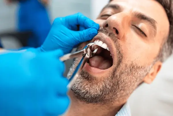 tooth extractions in delta, bc