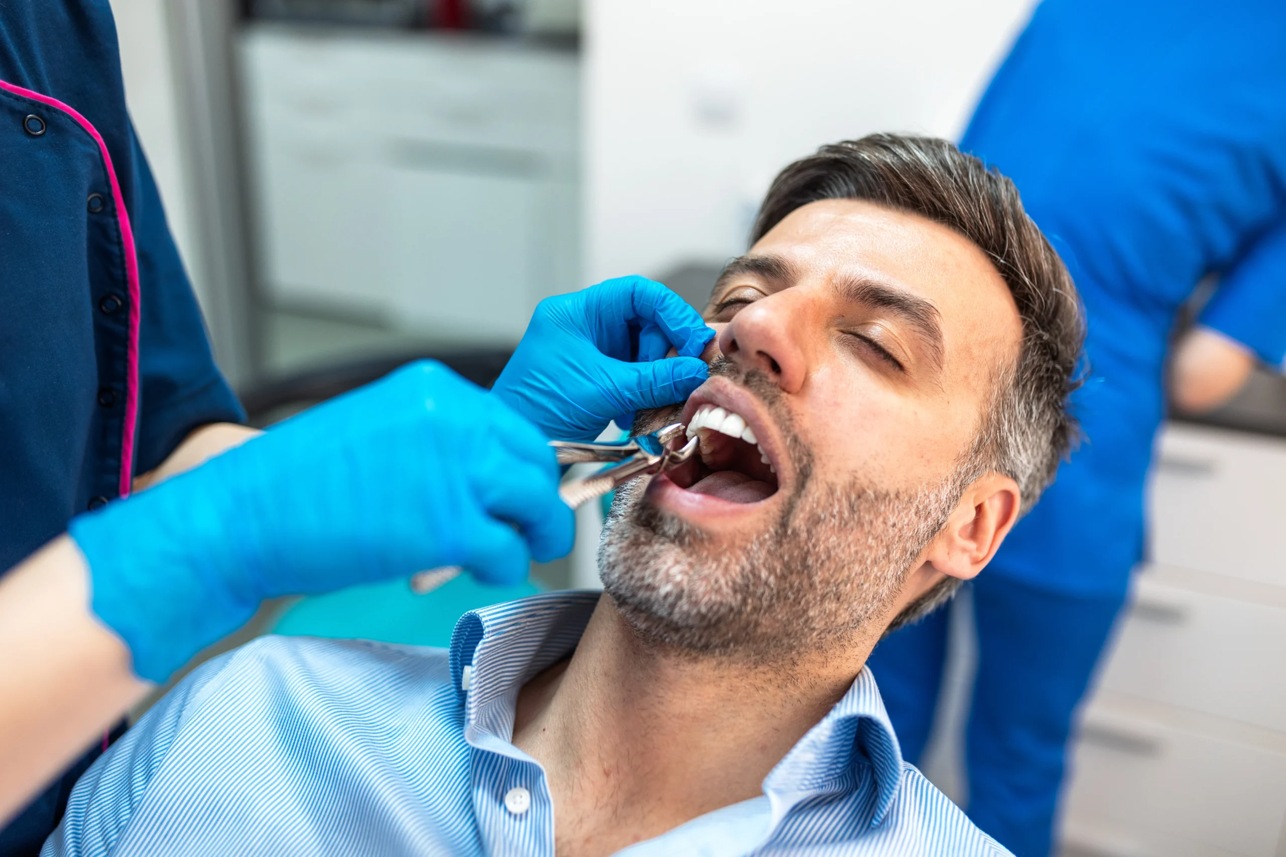 wisdom teeth extractions in delta, bc